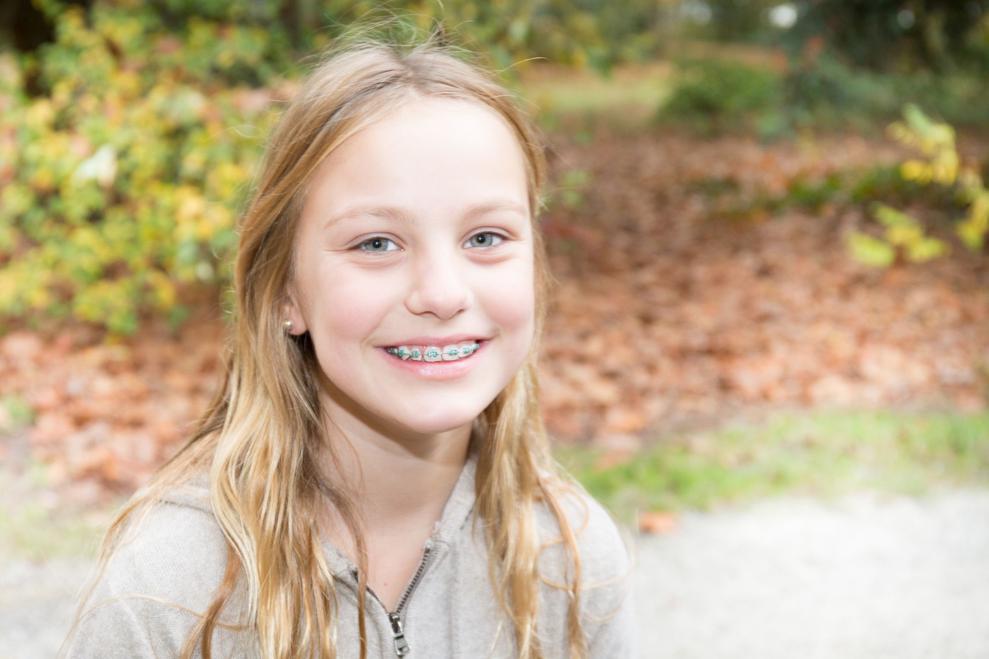 AdobeStock_199022723 sacramento orthodontics