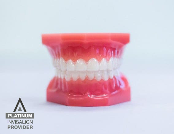 Invisalign treatment at Evrigenis Orthodontics image