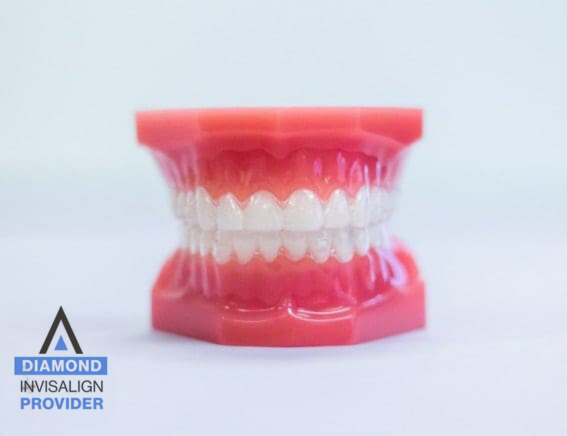 Invisalign treatment at Evrigenis Orthodontics image